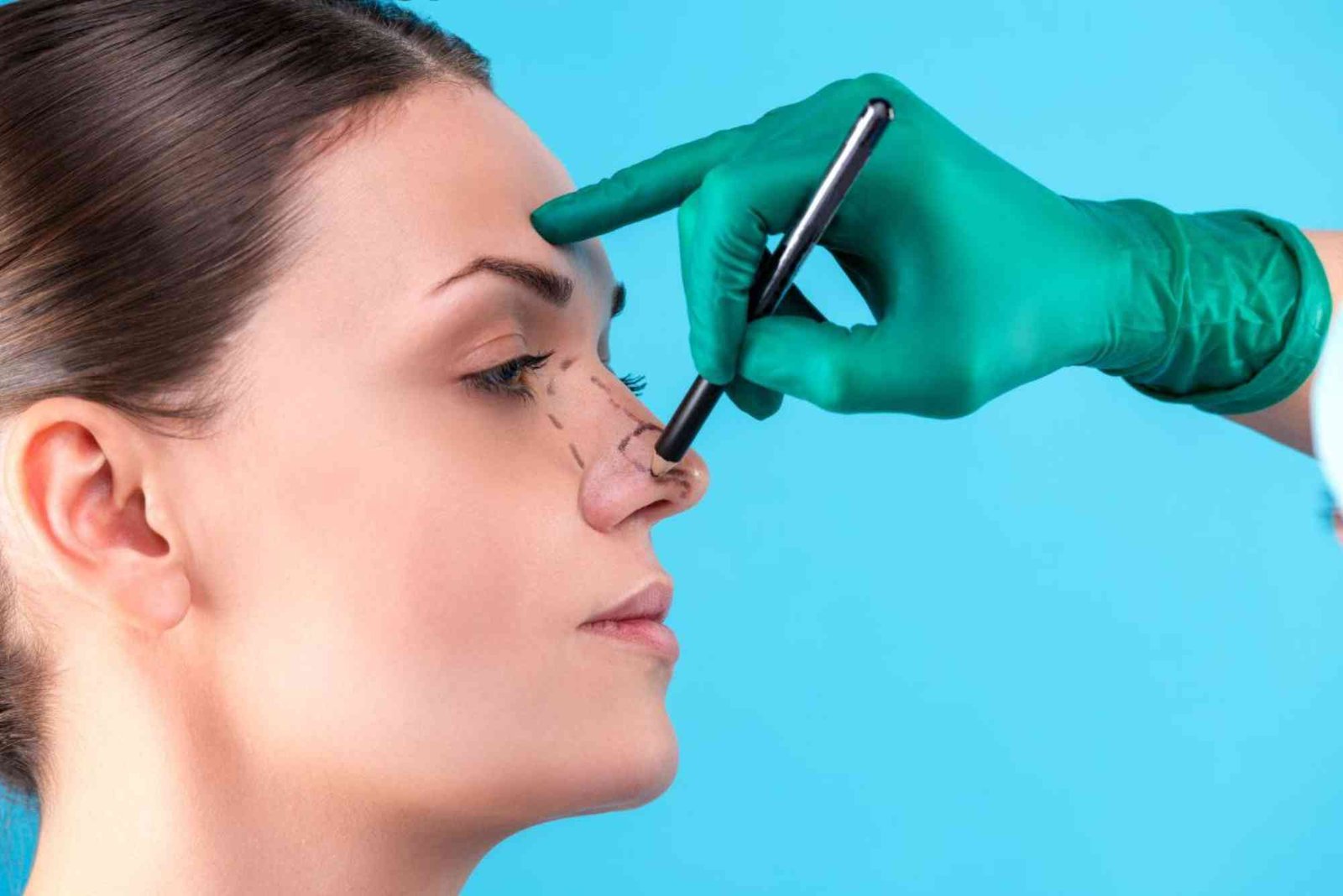 How Rhinoplasty Turkey Cost What You Should Know Works — Everything You Need To Know